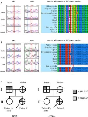 Abnormal Expression of Dysferlin in Blood Monocytes Supports Primary Dysferlinopathy in Patients Confirmed by Genetic Analyses